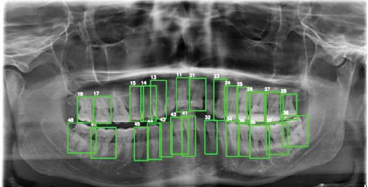 Teeth detection and numeric labeling visualization